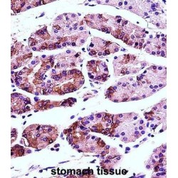 Anterior Gradient Protein 2 Homolog (AGR2) Antibody