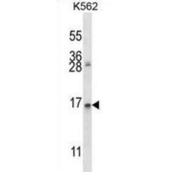 Anterior Gradient Protein 2 Homolog (AGR2) Antibody