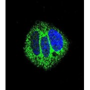 Retinoic Acid Receptor Alpha (RARA) Antibody