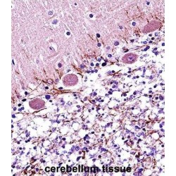 Retinoic Acid Receptor Alpha (RARA) Antibody