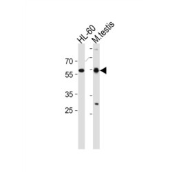 Retinoic Acid Receptor Alpha (RARA) Antibody