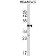 C-C Chemokine Receptor Type 9 (CCR9) Antibody