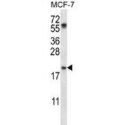 PYD And CARD Domain Containing (PYCARD) Antibody