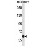 Potassium Voltage-Gated Channel Subfamily C Member 2 (KCNC2) Antibody