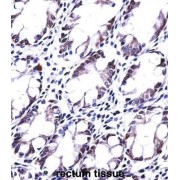 Phospholipase A and Acyltransferase 5 / HRASLS5 (PLAAT5) Antibody