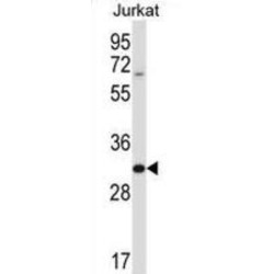 Phospholipase A and Acyltransferase 5 / HRASLS5 (PLAAT5) Antibody