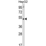 Matrix Metalloproteinase 20 (MMP20) Antibody