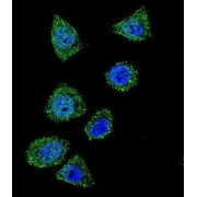 Topoisomerase I (TOP1) Antibody