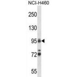 Topoisomerase I (TOP1) Antibody