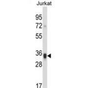 Killer Cell Immunoglobulin-Like Receptor 2DS1 (KIR2DS1) Antibody