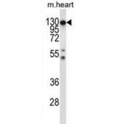 Macrophage Colony-Stimulating Factor 1 Receptor (CSF1R) Antibody