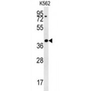 DiGeorge Syndrome Critical Region 14 (DGCR14) Antibody