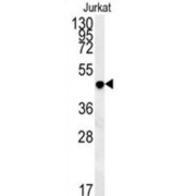 D-Amino Acid Oxidase/ DAMOX (DAO) Antibody