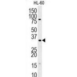 Translin-Associated Protein X (TSNAX) Antibody