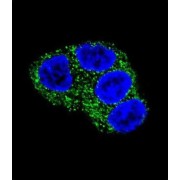 UDP-Glucuronosyltransferase 1-1 (UGT1A1) Antibody