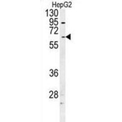 UDP-Glucuronosyltransferase 1-1 (UGT1A1) Antibody