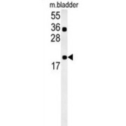 Coiled-Coil Domain Containing 12 (CCDC12) Antibody