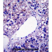 Patatin-Like Phospholipase Domain-Containing Protein 4 (PNPLA4) Antibody