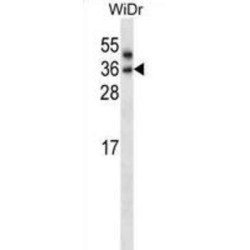 Patatin-Like Phospholipase Domain-Containing Protein 4 (PNPLA4) Antibody