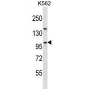 NOC3 Like DNA Replication Regulator (NOC3L) Antibody