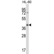 Fc Fragment of IgG, Low Affinity IIb, Receptor For (CD32) (FCGR2B) Antibody