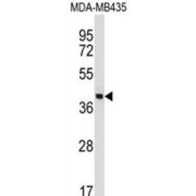 Pulmonary Surfactant-Associated Protein D (SFTPD) Antibody