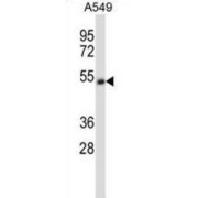 Cholinergic Receptor, Nicotinic Alpha 5 (CHRNA5) Antibody