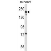 Leucine-Rich Repeat-Containing Protein 16B (LRRC16B) Antibody