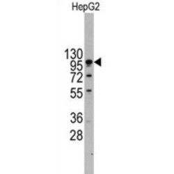 Cadherin 4 (CDH4) Antibody