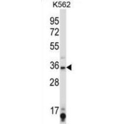 Sirtuin 6 (SIRT6) Antibody