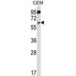 NADPH Oxidase 4 (NOX4) Antibody