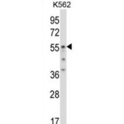 Ornithine Decarboxylase (ODC1) Antibody