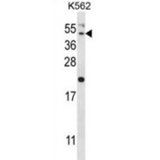 Hepatitis A Virus Cellular Receptor 1 (HAVCR1) Antibody