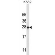 Interleukin 22 (IL22) Antibody