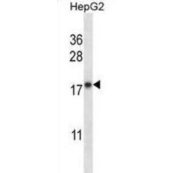 Cytochrome B5 Type A (CYB5A) Antibody