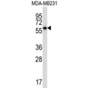 Western blot analysis of MDA-MB231 cell lysates (35 µg/ml) using Serine/threonine-Protein Phosphatase 2A 56 kDa Regulatory Subunit Gamma Isoform (PPP2R5C) Antibody.