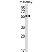 Somatostatin Receptor 1 (SSTR1) Antibody