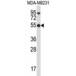 Hematopoietic Lineage Cell-Specific Protein (HCLS1) Antibody