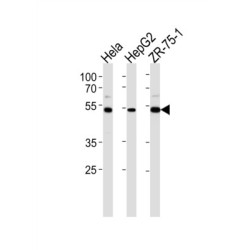 Telomeric Repeat Binding Factor 2 Interacting Protein (TERF2IP) Antibody