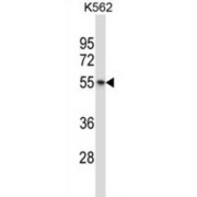 Vasopressin V1b Receptor (AVPR1B) Antibody