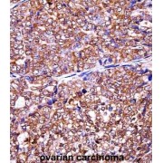 Eukaryotic Translation Initiation Factor 5A-2 (EIF5A2) Antibody