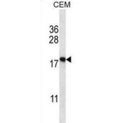 Eukaryotic Translation Initiation Factor 5A-2 (EIF5A2) Antibody