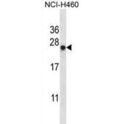 BAG Family Molecular Chaperone Regulator 2 (BAG2) Antibody