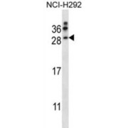 Neurturin (NRTN) Antibody