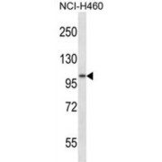 ADAM Metallopeptidase Domain 8 (ADAM8) Antibody