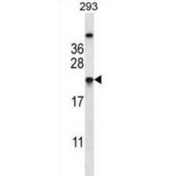 Transgelin-2 (TAGLN2) Antibody