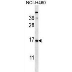 Cysteine And Glycine Rich Protein 2 (CSRP2) Antibody