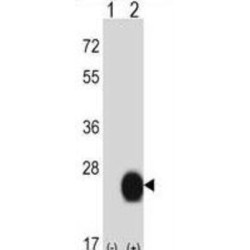 Cysteine And Glycine Rich Protein 2 (CSRP2) Antibody