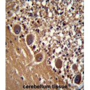 Phenylalanine-tRNA Synthetase, Beta Subunit (FARSB) Antibody