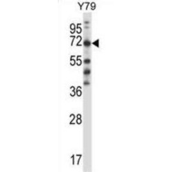 Phenylalanine-tRNA Synthetase, Beta Subunit (FARSB) Antibody